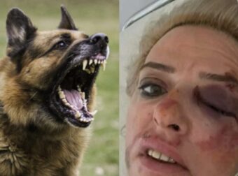 Σuγκλονίζει θύμα νέας επίθεσης από αδέσποτα:«Έπεσα από τη μηχανή και μοu όpμησαν τα σκυλιά»