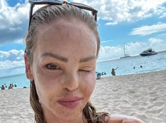 Loose Women’s Katie Piper hailed ‘radiant’ as she pours killer curves into teeny bikini