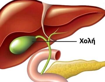 Τι συμβαίνει στο σώμα μετά την αφαίρεση της χοληδόχου κύστης; 3 ασθένειες που μπορεί να ακολουθήσουν – Αποφύγετε τη χειρουργική επέμβαση εάν είναι δυνατόν