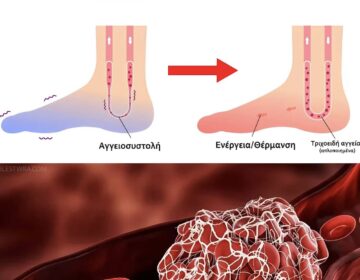 Πάνω από 50; Αυτές οι  βιταμίνες βελτιώνουν την κακή κυκλοφορία 